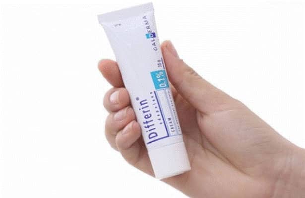Kem trị mụn Differin