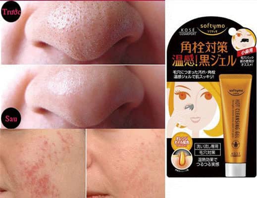 Kem trị mụn đầu đen Kose Softymo Hot Cleansing