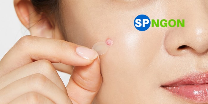 Top 10 Miếng Dán Trị Mụn được ưa chuộng trong năm
