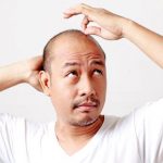 Top 10 Thuốc mọc tóc dành cho nam