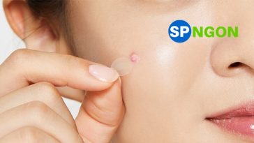 Top 10 Miếng Dán Trị Mụn được ưa chuộng trong năm