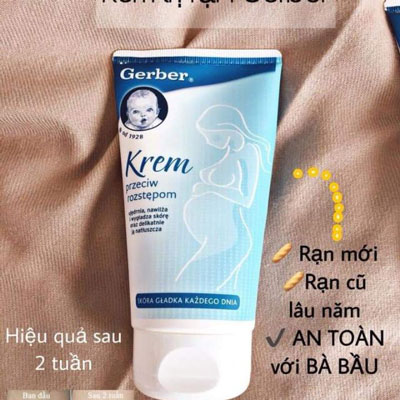 Kem trị rạn da Gerber (150ml)